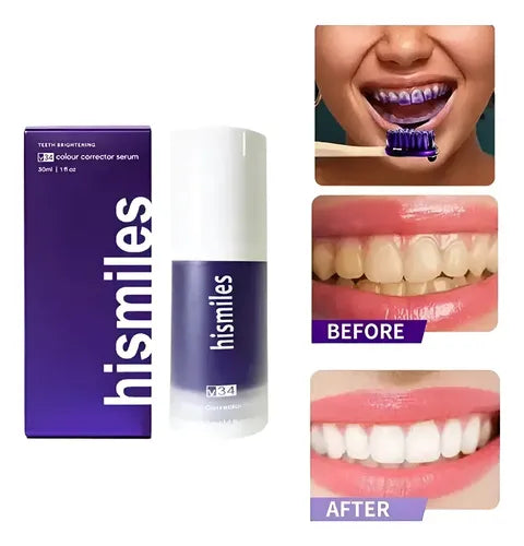 Blanqueador Dental